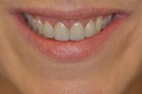 Dr. Emma Y. Wu Aesthetic Family Dentistry image 4